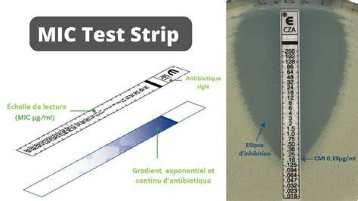 example of Mic detected