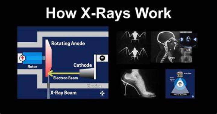 How can I scan x-rays on a flatbed scanner?